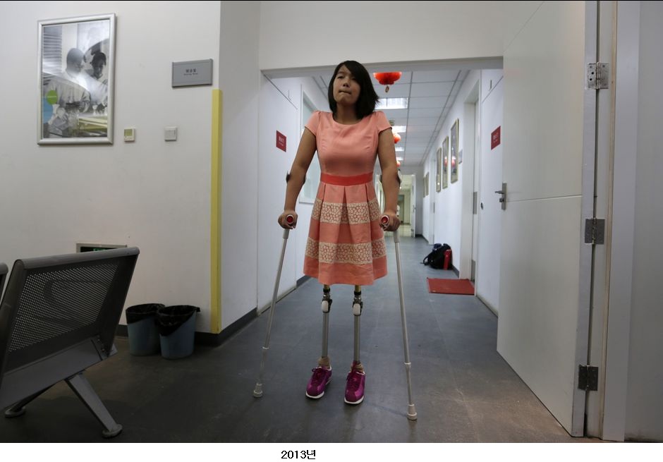 Qian-Hongyan-vient-chercher-ses-jambes-d-adulte-en-septembre-2013.jpg